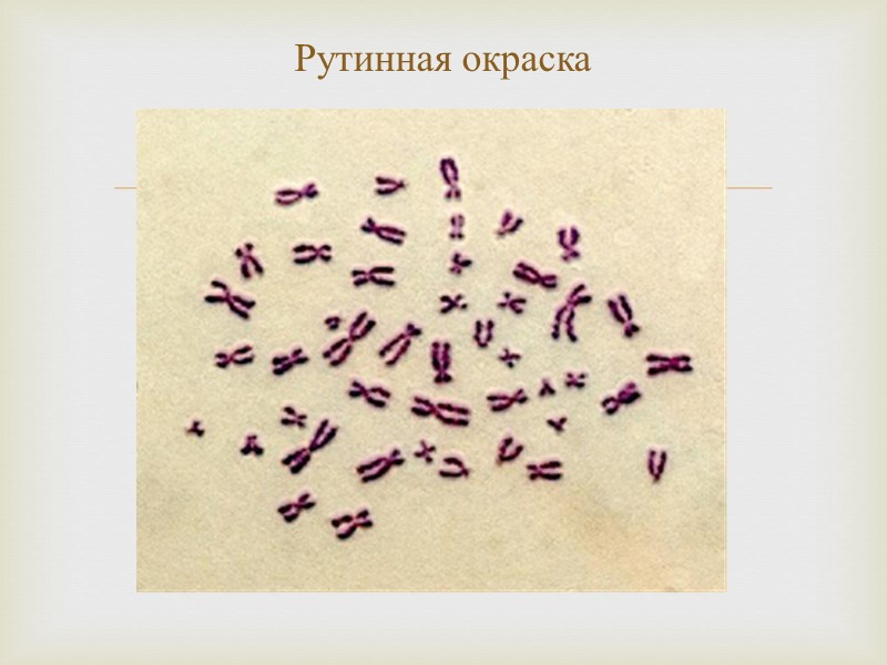 Рутинная окраска